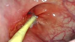 Pov anal extremo cÂmera dentro do cu dela enquanto eu a bate com meu pau grande e gozo bem dentro