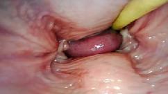 Pov interno incrÍvel cÂmera dentro da buceta dela enquanto eu a encho de porra